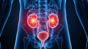 Urinary Tract Infection