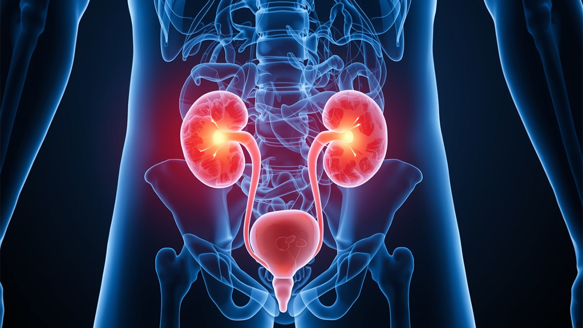 Urinary Tract Infection